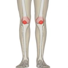 total-knee-replacement-300x300.jpg